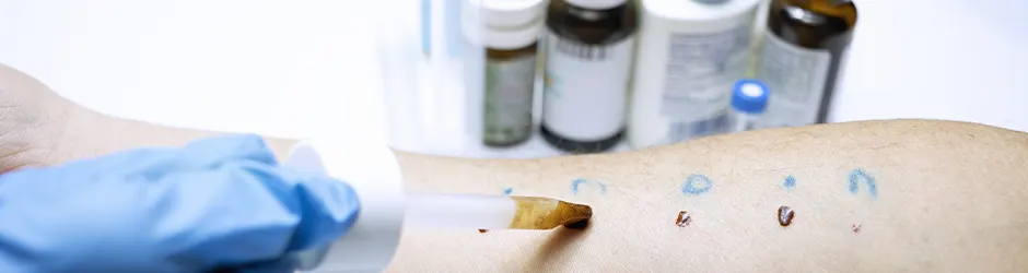 Phasen der Allergiebehandlung und -nachsorge